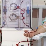 patient monitored by electronic sphygmomanometer during dialysis session
