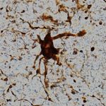 210325_Zombie_genes_001