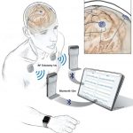210512_Wireless-recording-of-brain-activity_001
