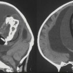 230313_Parasitic-twin_00001