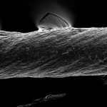 230622_Smart-Sutures_00001