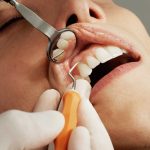 230818_teeth_0000001