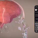 240130_Neuralink_00001
